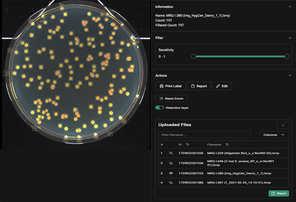 AI-assisted colony counting interface showing automated detection, filtering controls, and batch processing